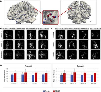 Assessing Fine-Granularity Structural and Functional Connectivity in Children With Attention Deficit Hyperactivity Disorder